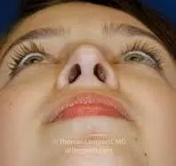Avatar of nostril 