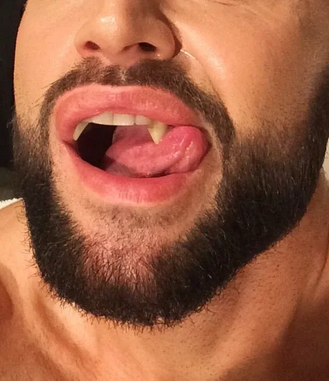 Avatar of vampirism ⚠️possible non-con⚠️