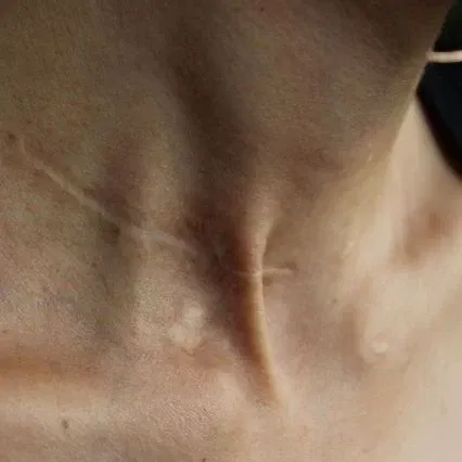 Avatar of Remus Lupin
