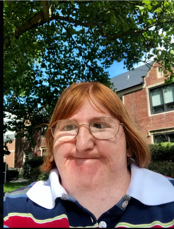 Avatar of Cyanide Heroin Poisoning