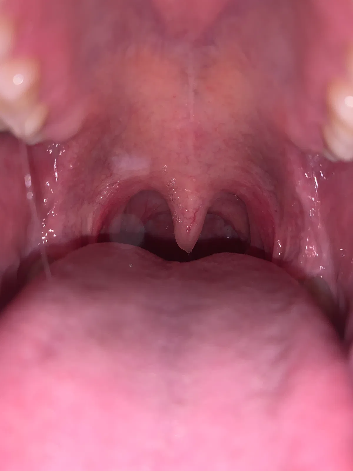 Avatar of Unknown (Vore)
