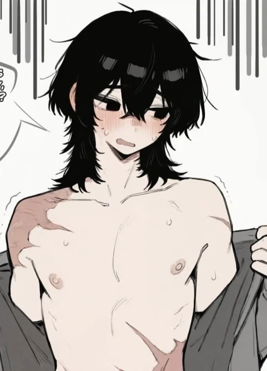 Avatar of Max – insecure burned boy friend