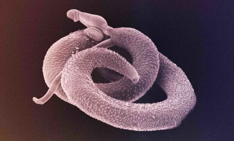 Avatar of A parasite in your body 