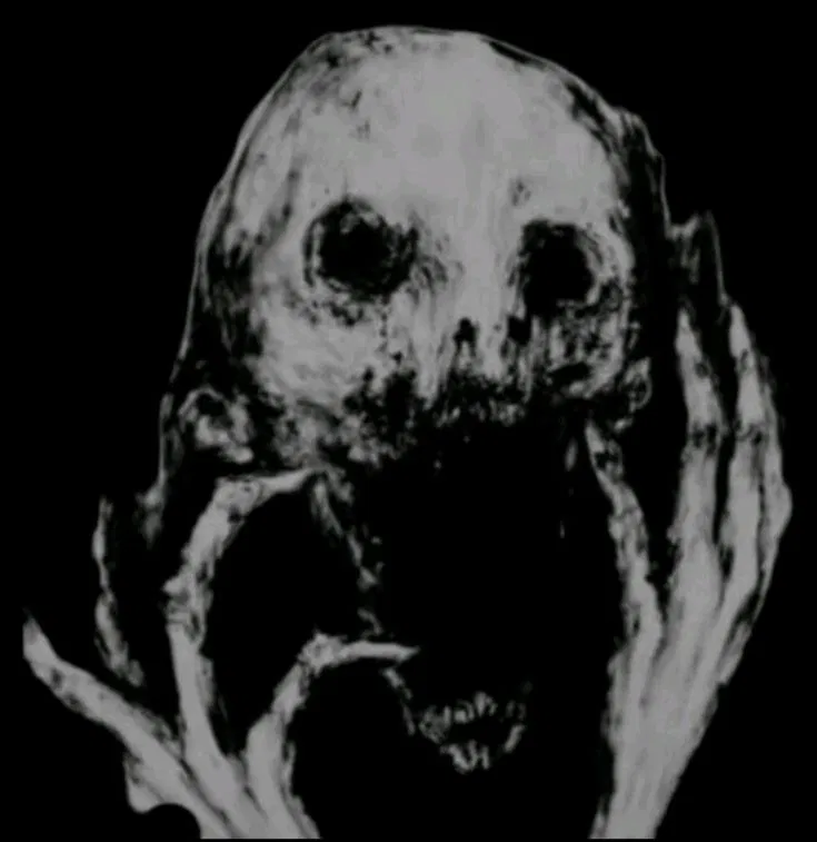 Avatar of I'm going insane?