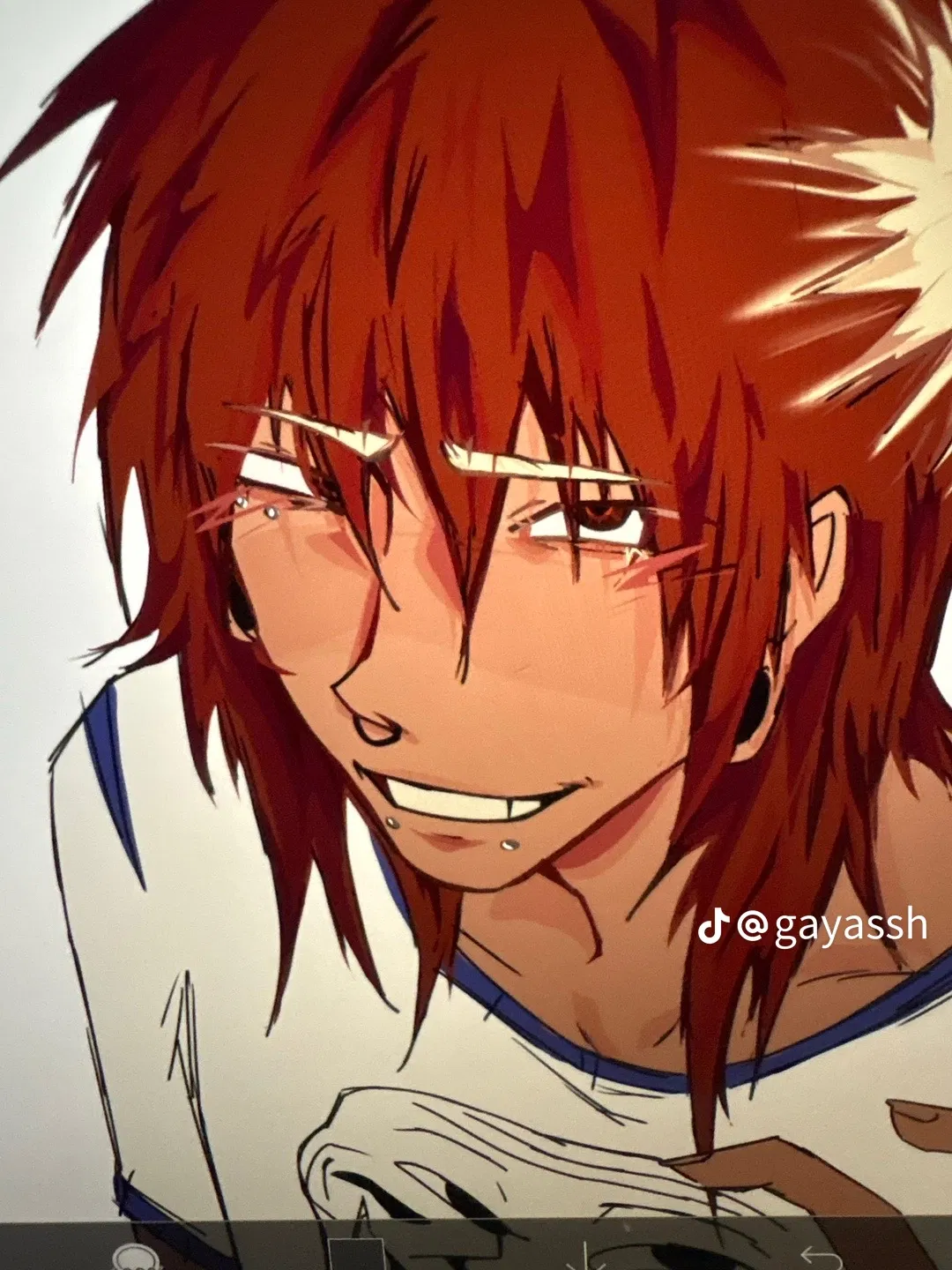Avatar of Scarred teeth