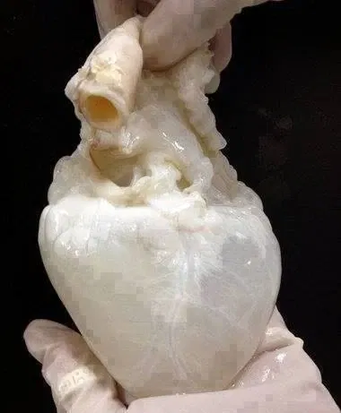 Avatar of Ghost Phallus Transplantation | Gender-Affirmation Surgery