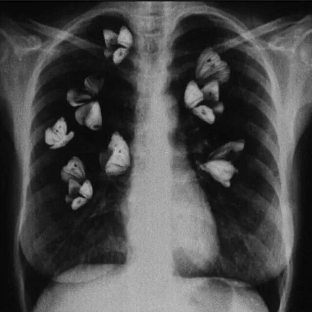 Avatar of Flower infection