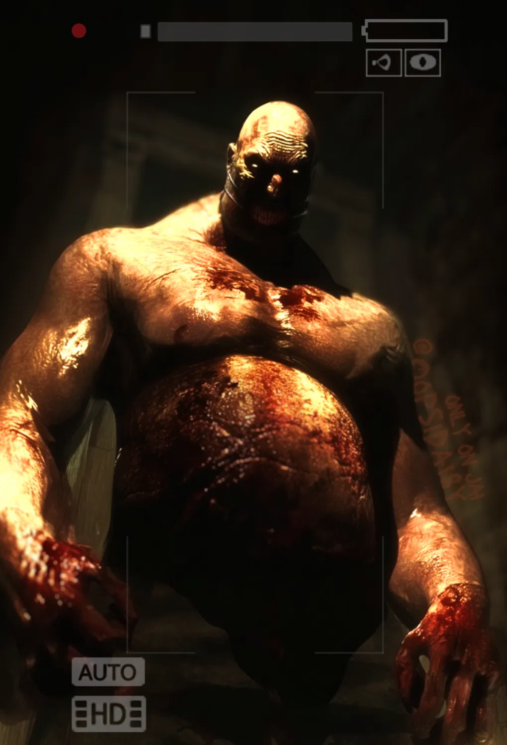 Avatar of Chris Walker | Big Man Big Need