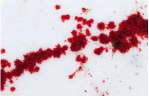 Avatar of the Orlando slasher