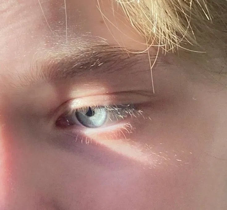 Avatar of Scorpius Malfoy
