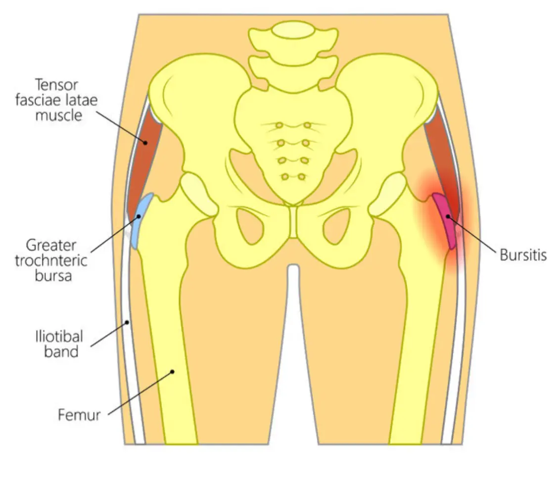 Avatar of I have horrible hip pain rn